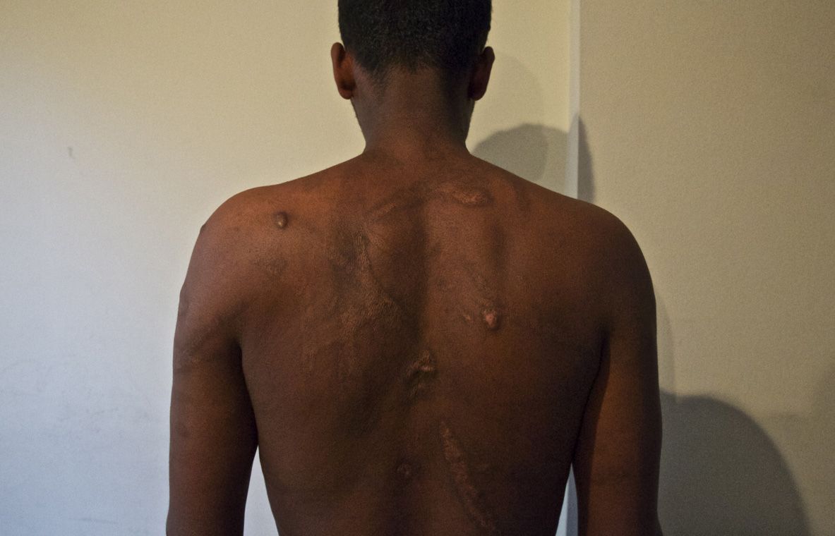 Traffickers torture for profit