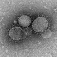 Health Ministry confirms first case of Middle East Respiratory Syndrome in Egypt