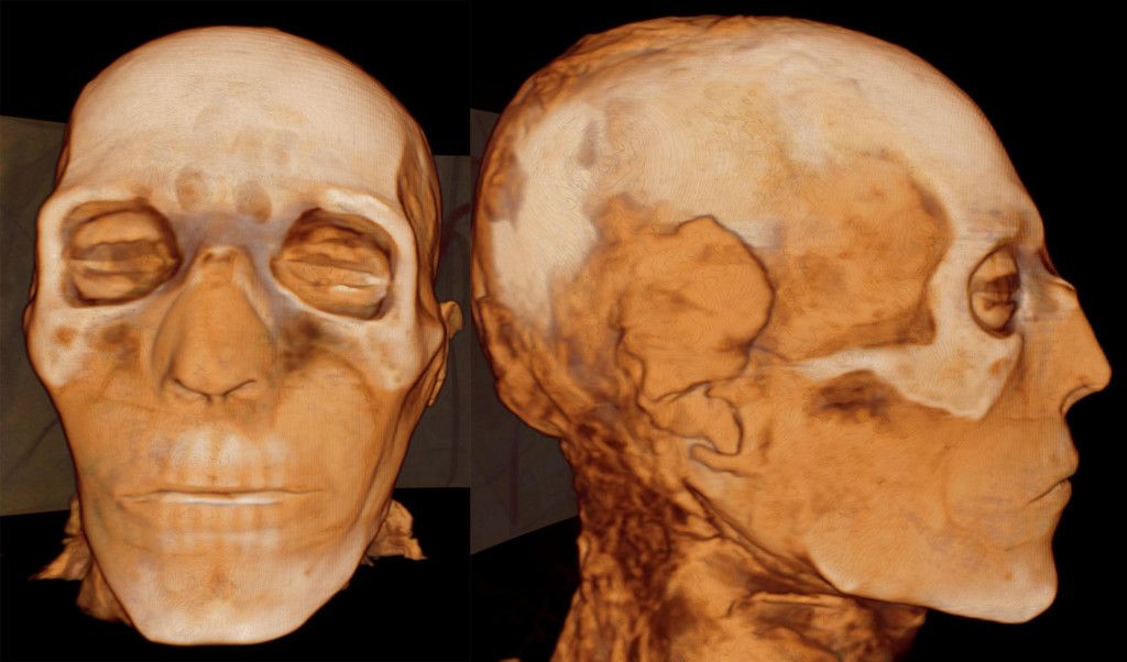 Scanning the Pharaohs: A new book on Zahi Hawass’s Egyptian Mummy Project