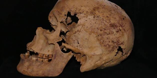 Antiquities Ministry: 4,200 year-old mummy shows oldest signs of breast cancer