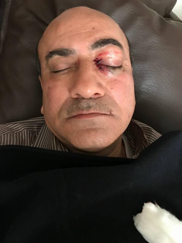 من «بهجت» إلى «جنينة»: «شرنوخ».. «متهم / مجني عليه» في حادثتي سير بينهما عامان