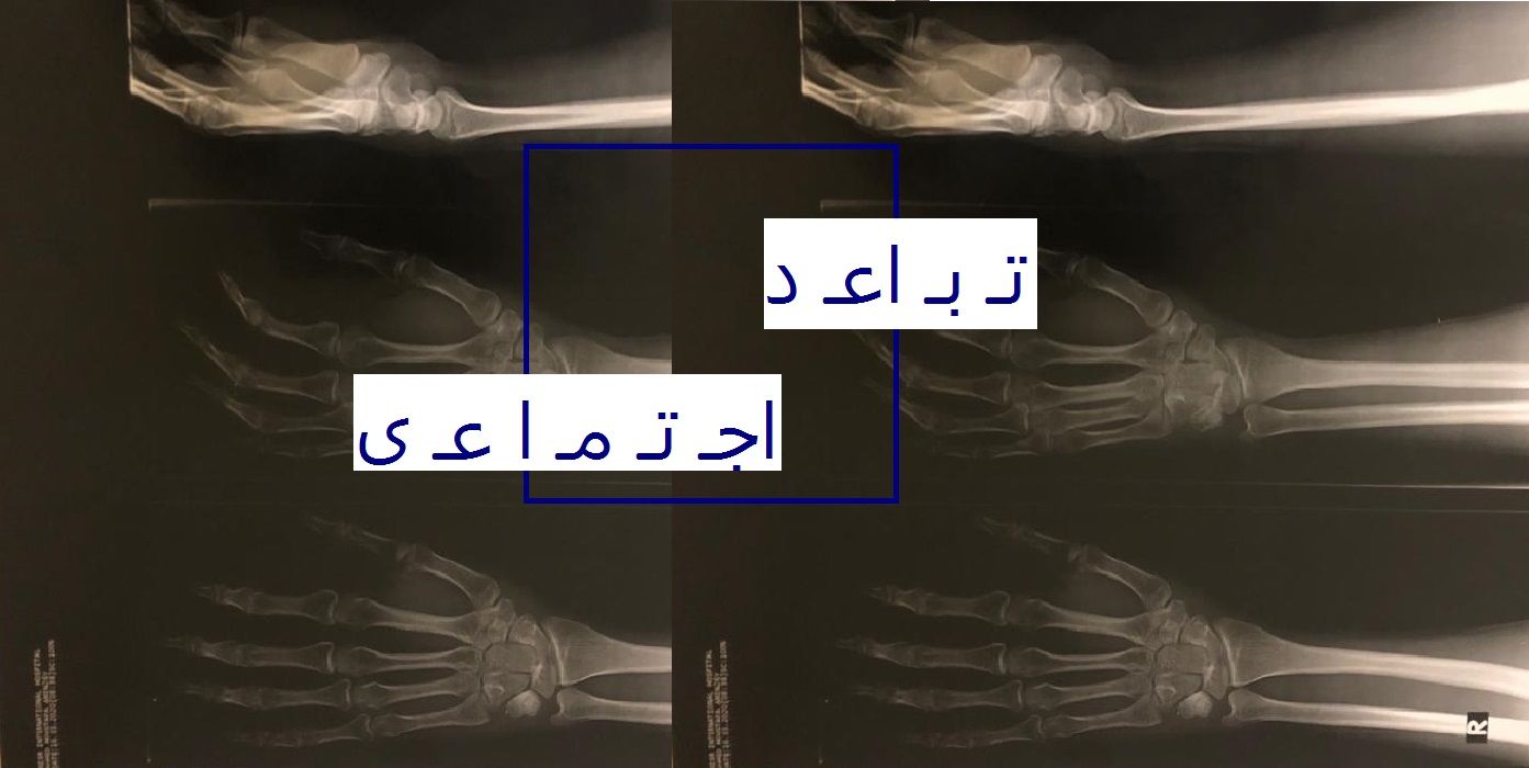 مفردات عالم الكورونا| «تباعد اجتماعي»