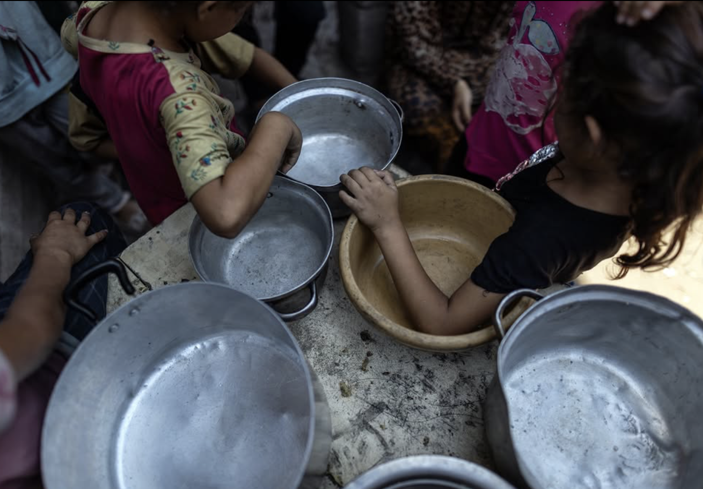 Hospitals receiving 120 malnutrition patients daily in Gaza, Health Ministry official says