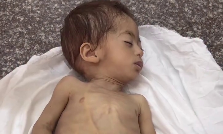 7 قتلى بالتجويع و3 أمام «غزة الإنسانية» رغم استمرار وصول المساعدات لـ«كرم أبوسالم»