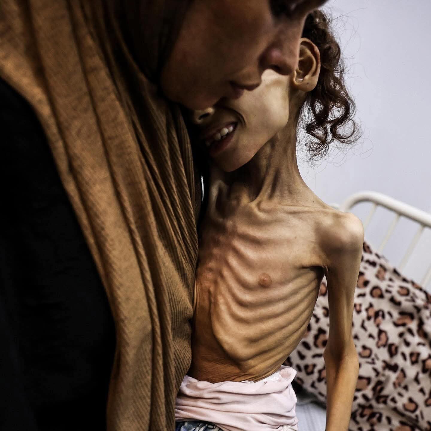أطفالٌ ضمن قتلى القصف والجوع في غزة.. و«رويترز»: «حماس» وافقت على مقترح وقف إطلاق النار