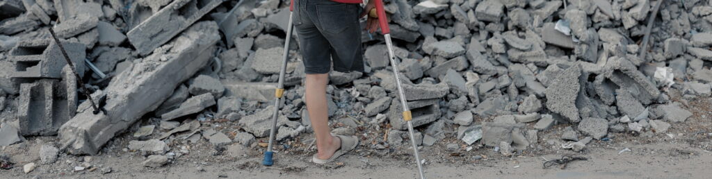 مأساة الأطفال مبتوري الأطراف في غزة